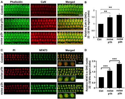 Treatment With Calcineurin Inhibitor FK506 Attenuates <mark class="highlighted">Noise-Induced Hearing Loss</mark>